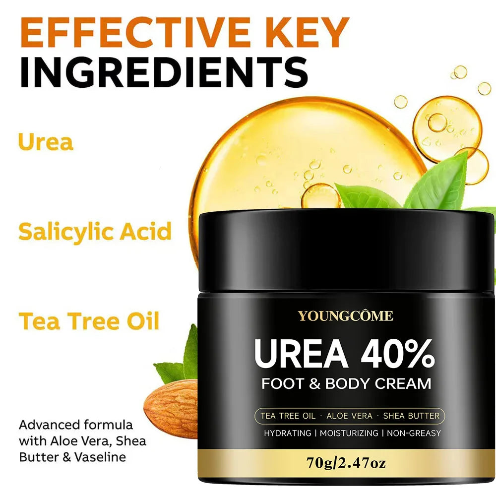 Urea 40% Foot Cream – Dry Cracked Heel & Skin Repair | YOUNGCOME