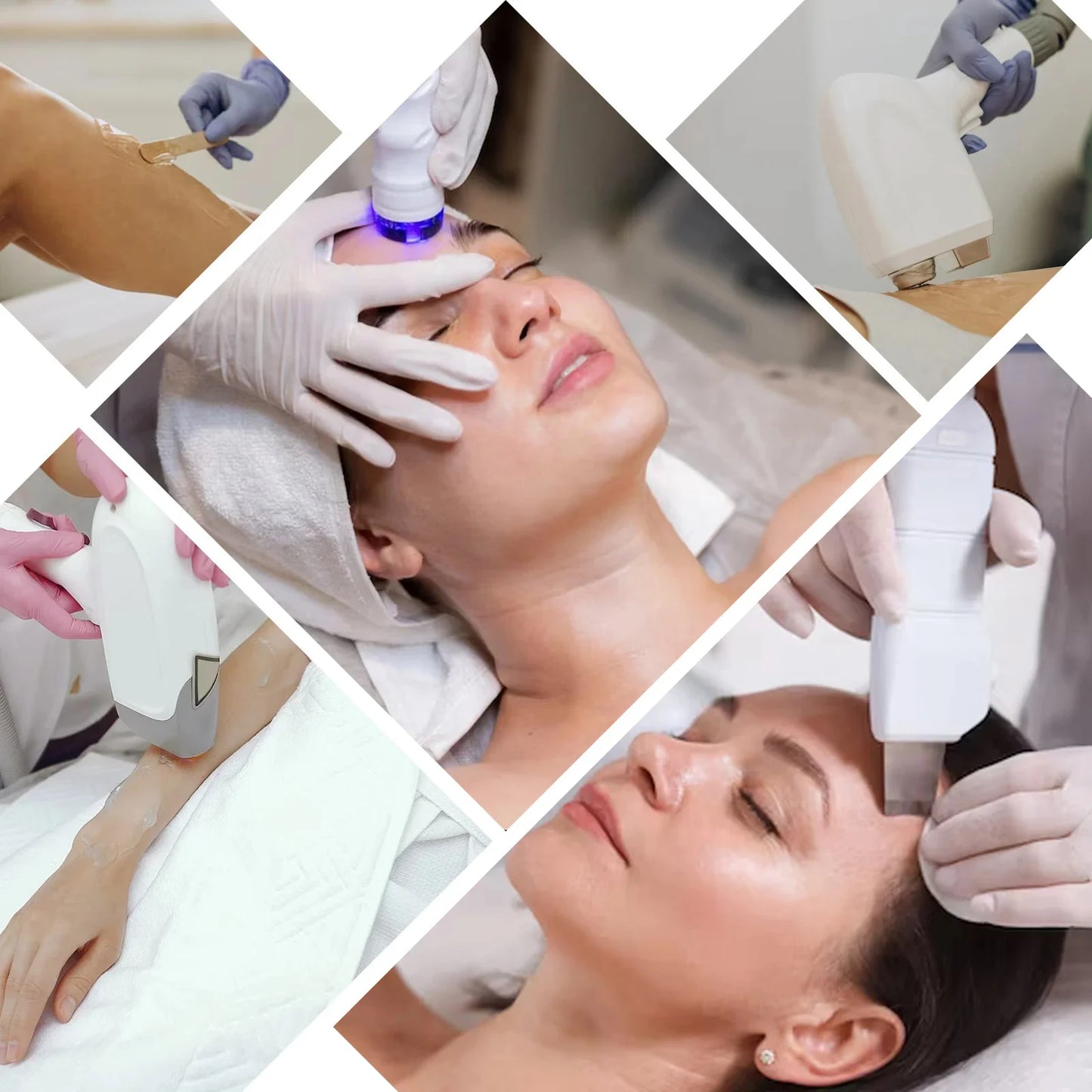 VamsLuna 300ml Cooling Gel for IPL & Laser Hair Removal