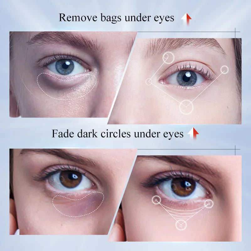 Kojic Acid & Retinol Eye Cream – Brightening & Firming