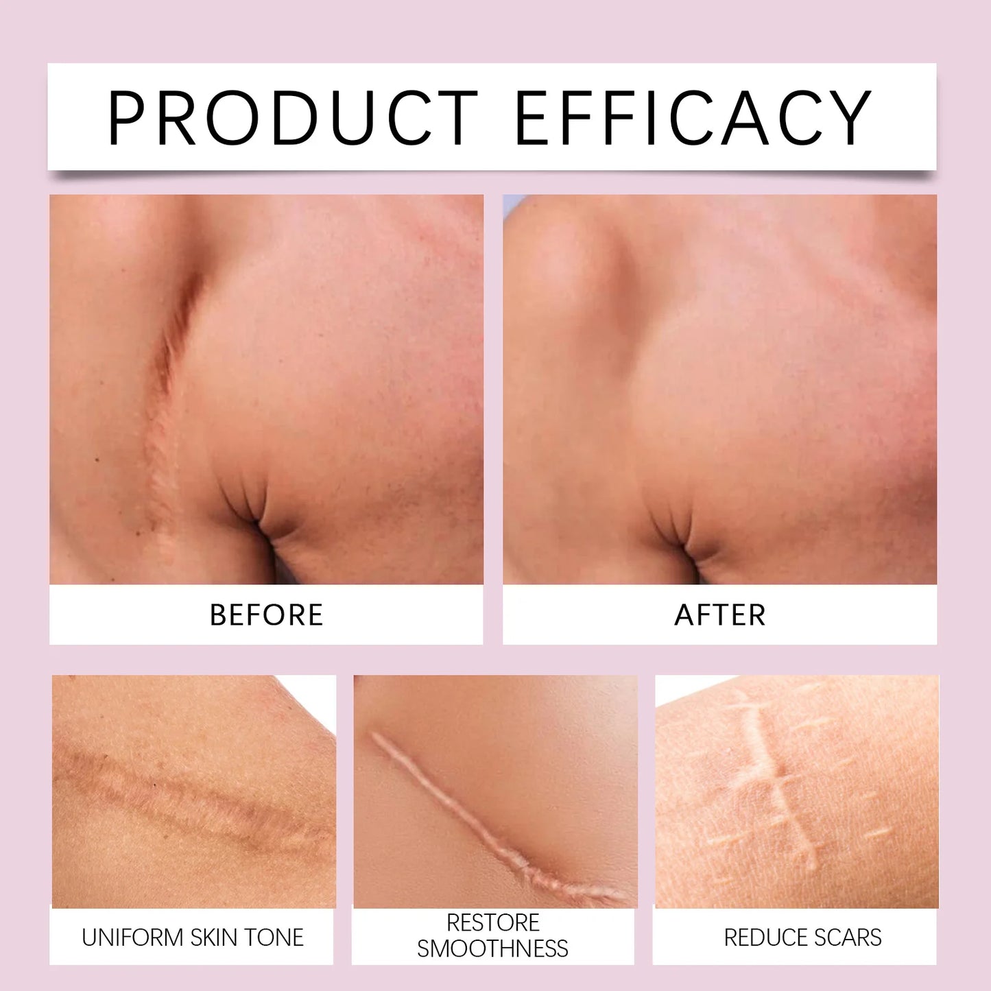 Invisible Clear Facial Gel Patches – Blemish Cover & Fine Lines
