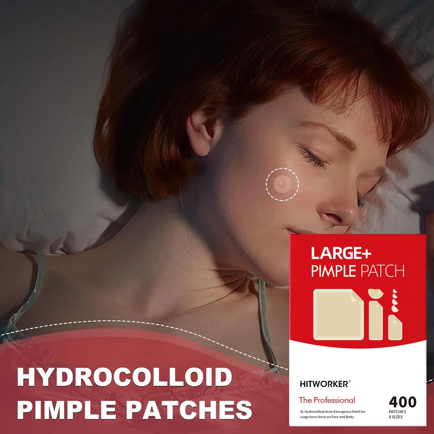 Invisible Waterproof Hydrocolloid Acne Patches – All Skin Types