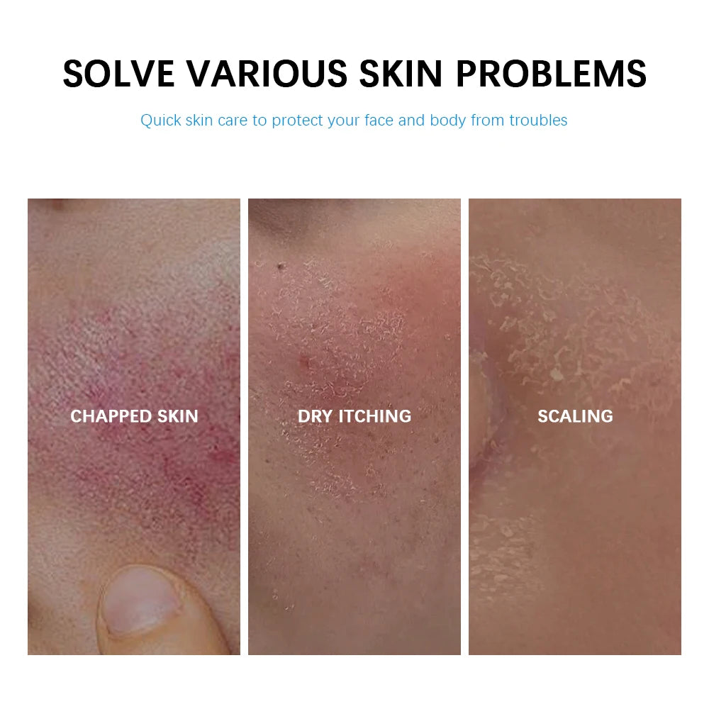 Soothing Multi-Purpose Hydrating Cream Reduces Redness Daily Helps Relieve Rough Cracked Skin Deep Skin Care Peaceful Pleasures Health and Wellness