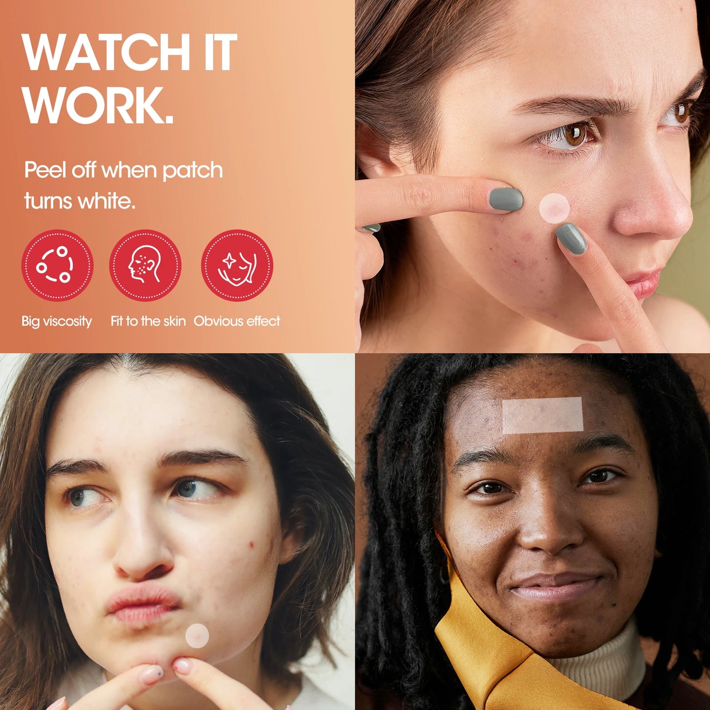 Hydrocolloid Acne Patches – Invisible, Waterproof | All Skin Types
