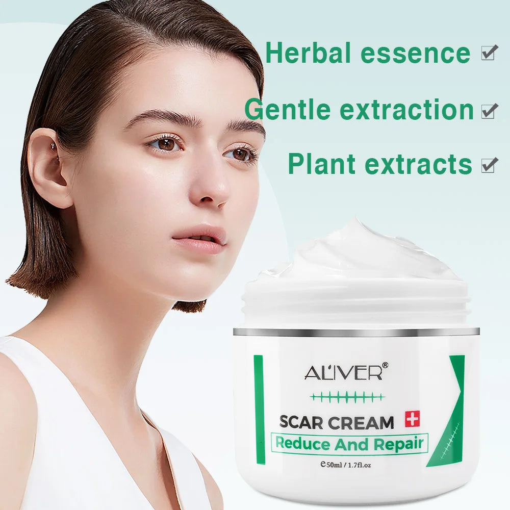 ALVER Acne Scar & Stretch Mark Remover Cream – 50ml Peaceful Pleasures Health and Wellness