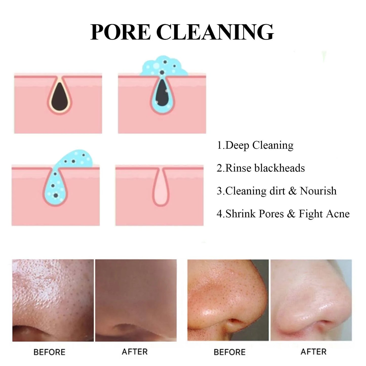 Blackhead Cleansing Mud Mask 40g – Pore-Purifying & Brightening