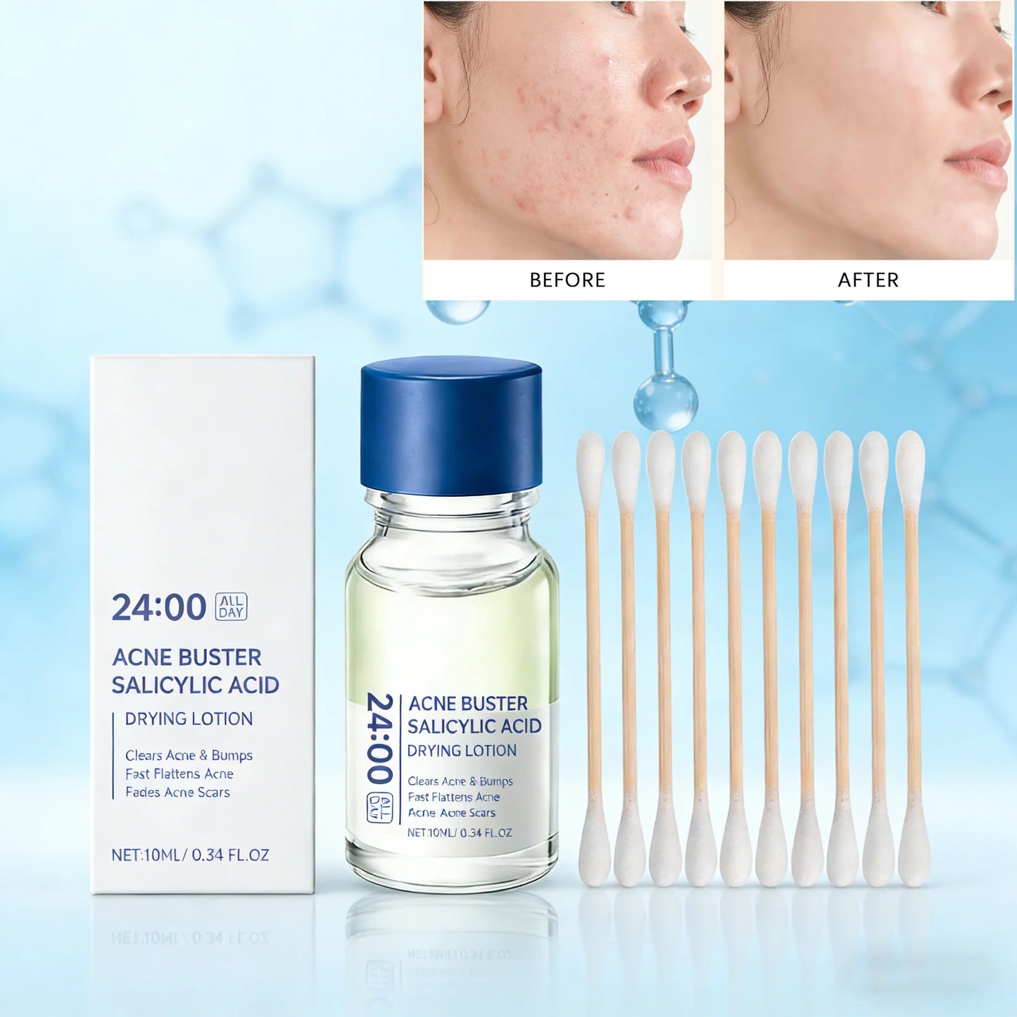 Salicylic Acid Acne Serum – Blackhead & Oil Control Essence Peaceful Pleasures Health and Wellness