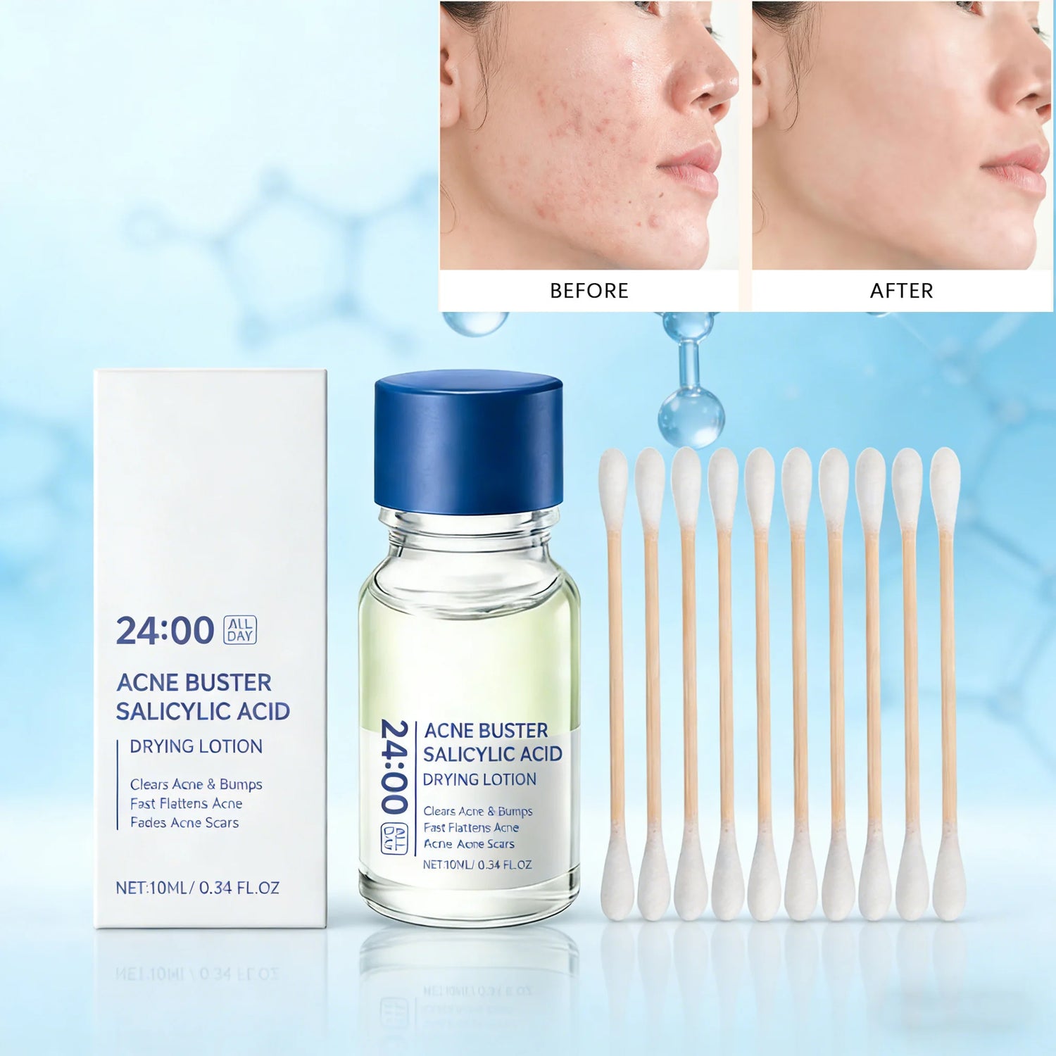 Salicylic Acid Acne Serum – Blackhead & Oil Control Essence Peaceful Pleasures Health and Wellness