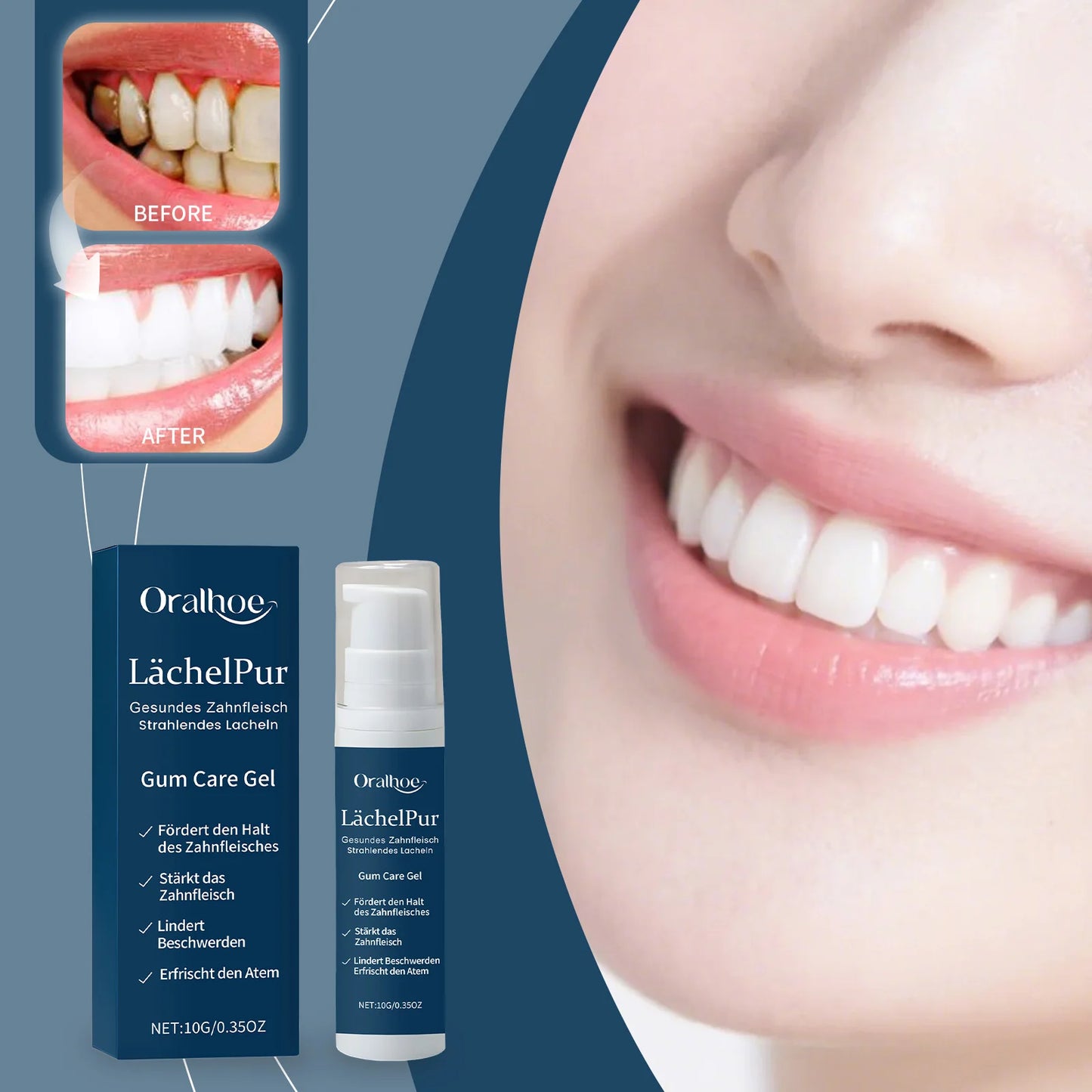 Botanical Gum Soothing Gel | Fresh Breath Oral Care Essence