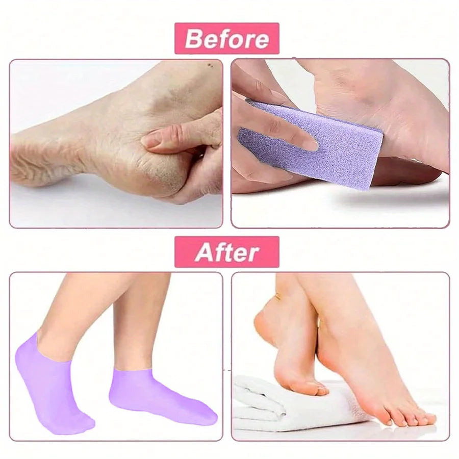 Silicone Moisturizing Foot Socks for Dry Cracked Heels & Massage