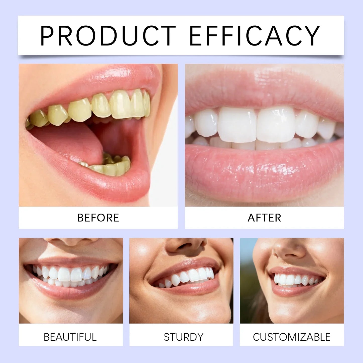 Oralhoe Purple Teeth Whitening Strips – 14 Strips Bright Smile