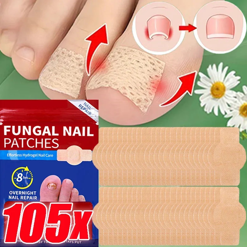 Nail Repair Patches – Toenail Care & Ingrown Correction Stickers