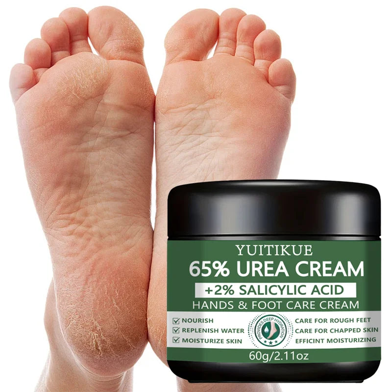 YUlTlKUE 65% Urea Cream +2% salicylic Acid Hands & Foot Care Cream Moisturize Rough chapped skin Nourish Hydrate 60g Peaceful Pleasures Health and Wellness