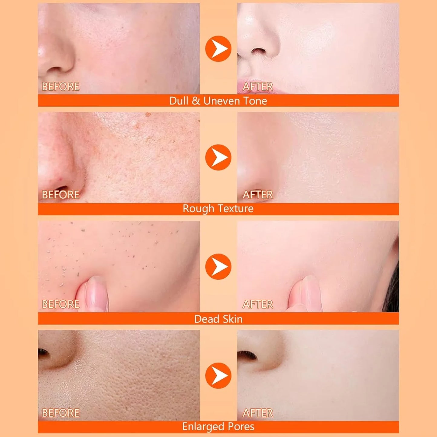 Kojic Acid & Turmeric Brightening Body Spray – Dark Spots