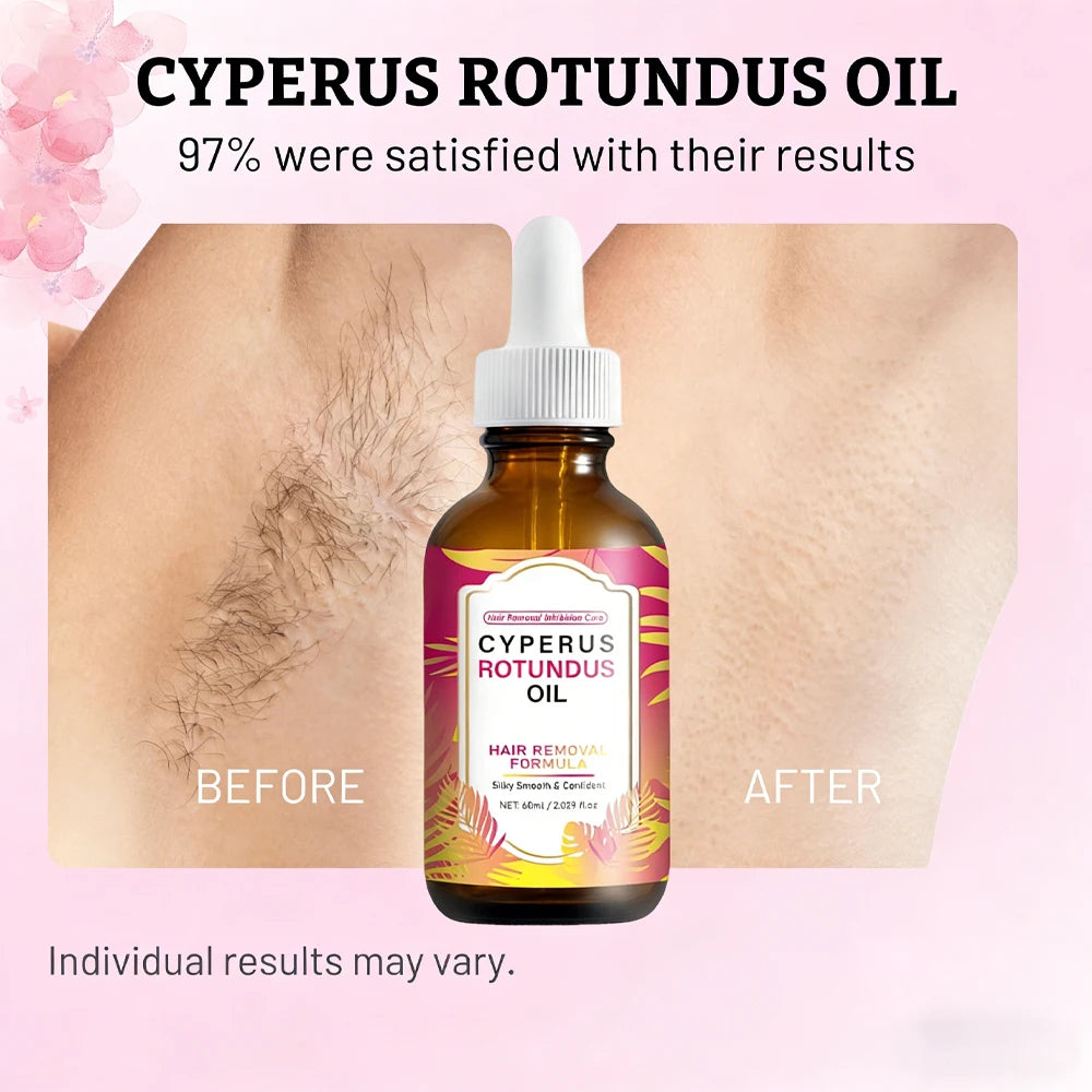 Cyperus Rotundus Oil For Hair Removal Soft Smooth Skin Care Deep Hydration Anti Hair Growth Inhibition After Shave Oil,60ml Peaceful Pleasures Health and Wellness