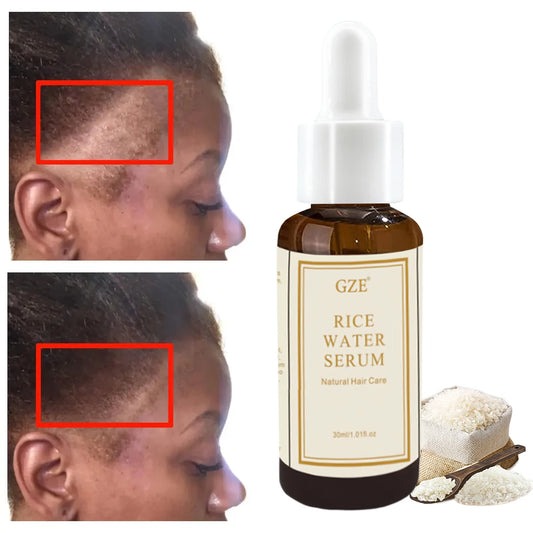 GZE Organic Rice Water Serum for Hair Growth & Skin | 30ml Hair Growth Serum Peaceful Pleasures Health and Wellness GZE092