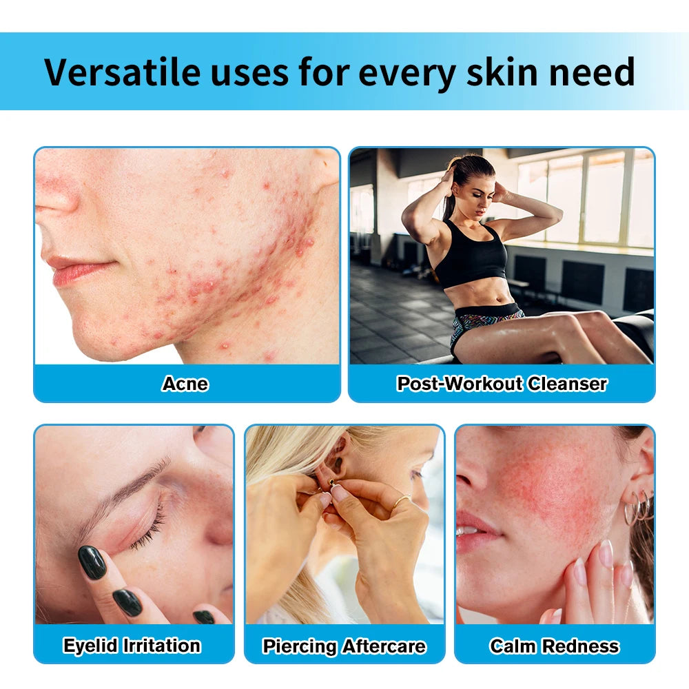 Hypochlorous Acid Facial Spray Reduce redness swelling acne Versatile uses for every skin Calm Redness Eyelid lrritation Care Sk Peaceful Pleasures Health and Wellness