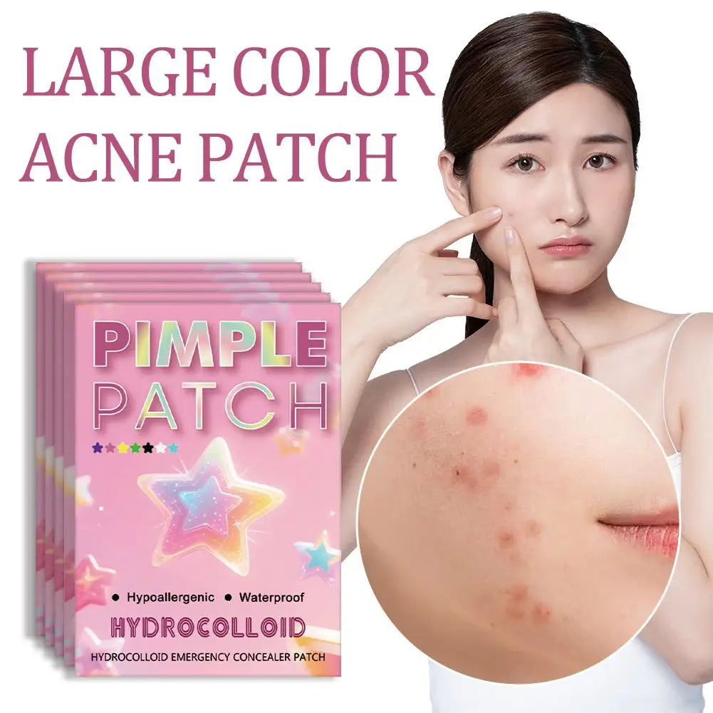 1400-Count Star Hydrocolloid Pimple Patches – Assorted Sizes