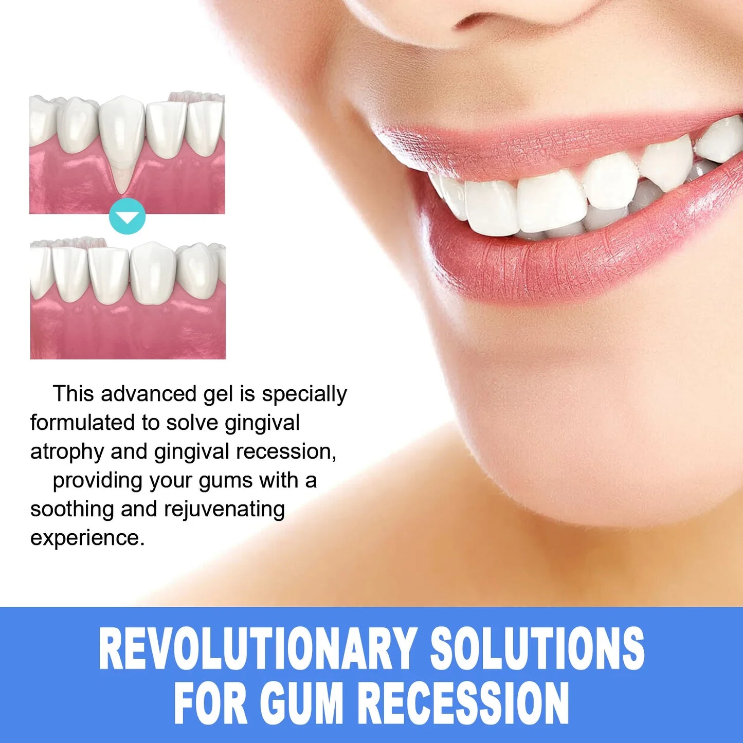 EELHOE Teeth Whitening Gel – Gum Repair & Stain Removal