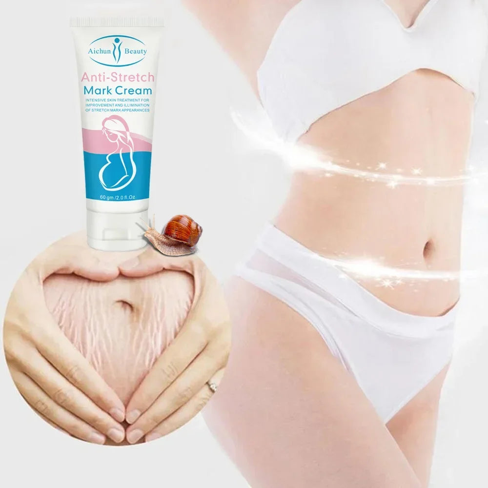 Snail Removes Stretch Mark Cream To Remove Postpartum Obesity Pregnant Women Repair Anti-Aging Anti-Winkles Firming Body Cream Peaceful Pleasures Health and Wellness