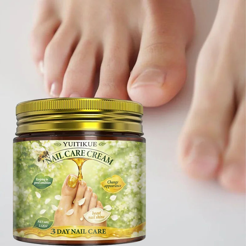 Yuitikue 3 Day Nail Care Cream, 60g Nail Repair Cream to Boost Nail Shine, Improve Nail Condition & Appearance Peaceful Pleasures Health and Wellness