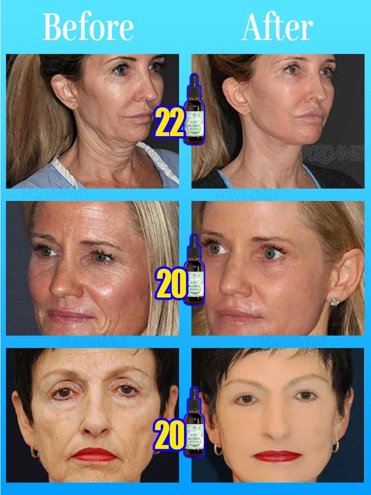 POZOAMIS Anti-Aging Face Serum | Wrinkle & Moisturizing
