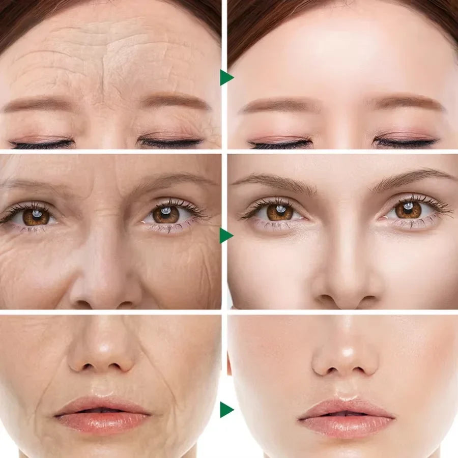 20-Pack Hyaluronic Acid Capsule Serum – Anti-Aging & Brightening