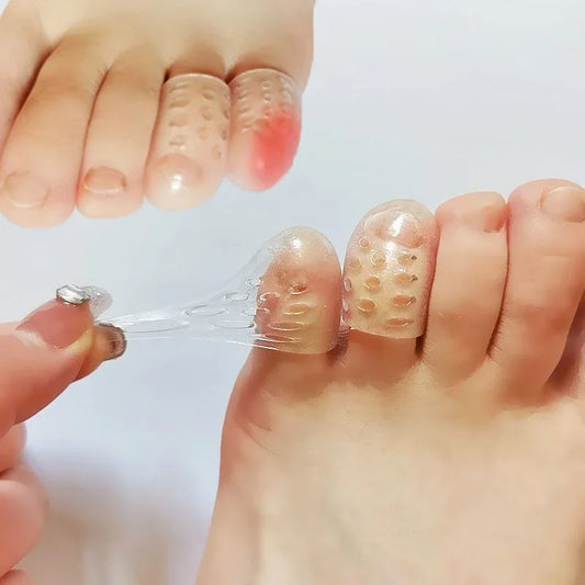 Silicone Toe Protector Caps – Anti-Friction | 5 or 10 Pack Silicone Toe Protector Oasis Select