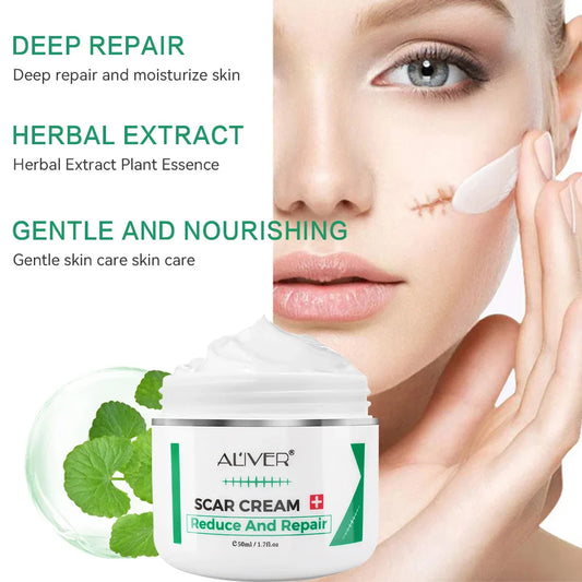ALVER Skin Repair Cream – Acne Marks, Dark Spots & Scars 50ml Skin Repair Cream Oasis Select