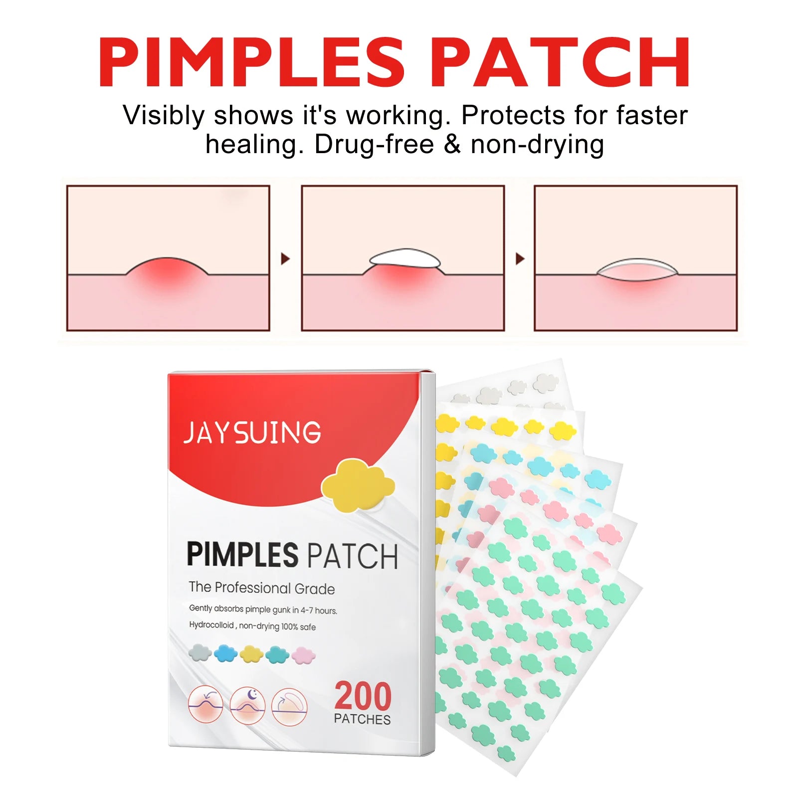 200PCS Cloud Acne Spot Patches Fade Imperfections Cover Pimples Hydrogel Invisible Acne Scar Fading Tool Skincare Tool Peaceful Pleasures Health and Wellness
