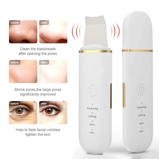 Professional Ultrasonic Facial Peel Cleaner High Beauty Product Electric Sonic Skin Scrubber Spatula for Nose Lips Exfoliating Peaceful Pleasures Health and Wellness