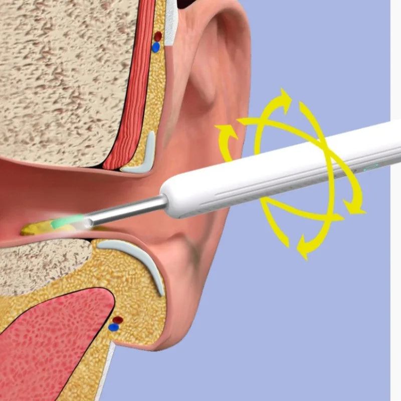 Ear Wax Removal with 6 Pcs Ear Set Ear Canal Cleaner with HD 1080P Camera Ear Cleaning Kit Otoscope for IOS & Android Peaceful Pleasures Health and Wellness
