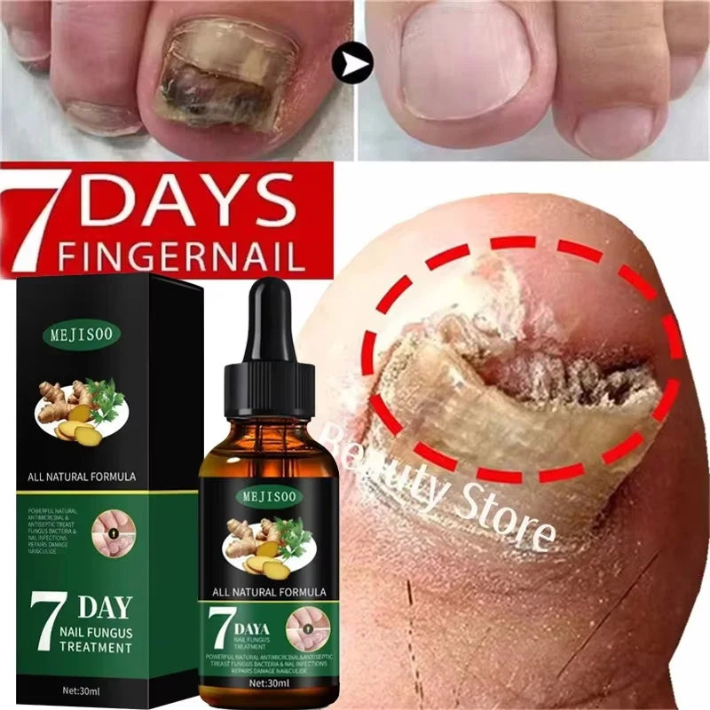 Nail Repair Serum – Nourishing Nail & Cuticle Treatment 30ml