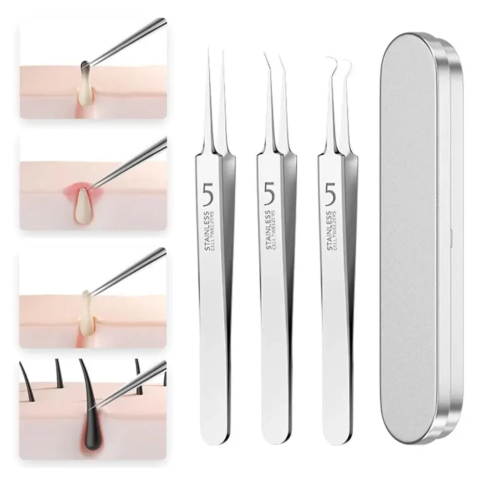 Professional Facial Blackhead Remover Tweezers,3Pcs Precision Pimple Popper Tool Kit for Whitehead Ance Blemishs Comedones Peaceful Pleasures Health and Wellness