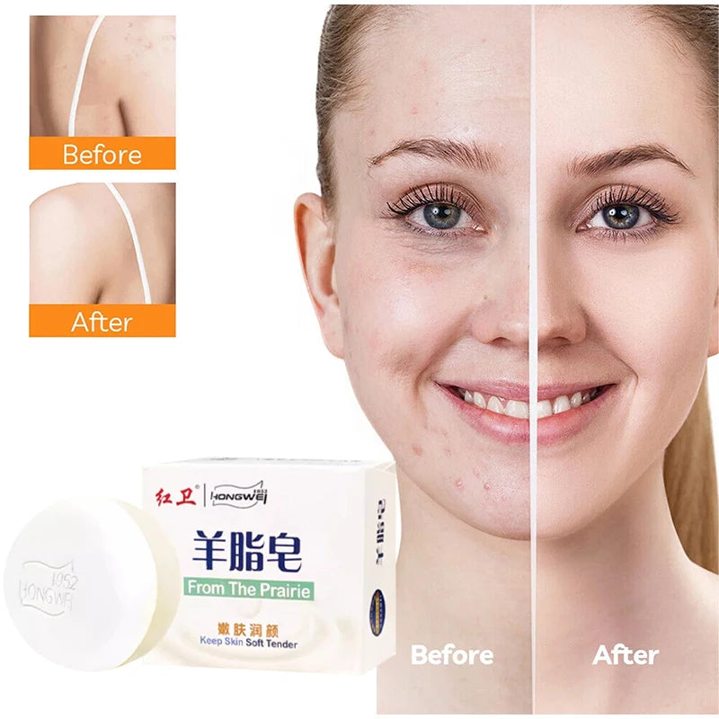 Hongwei Sheep Fat Soap 1952 Brand Natural Mild Ingredients Shampoo Face Bath Three-in-one Deep Cleansing Multifunctional Soap Peaceful Pleasures Health and Wellness