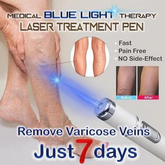 Skin Tag Removal Pen, Mole And Wart Removal Pen High-quality Anti Swelling Vessel Bulge Pain Blood Circulation Peaceful Pleasures Health and Wellness