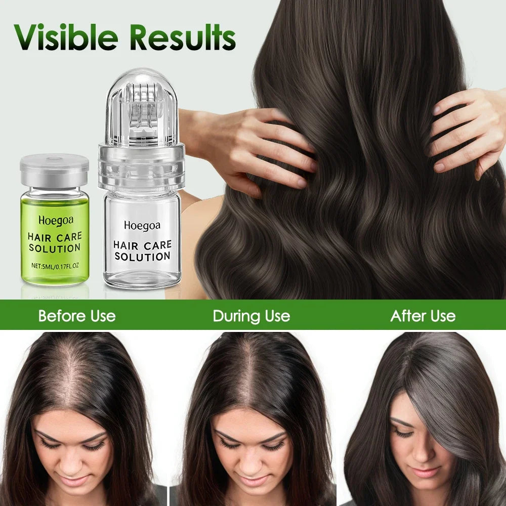 Hair Essential Care Serum Strengthen Roots Reducing Loss Prevent Baldness Nourish Scalp Hair Care Anti-Hair Loss Conditioner Peaceful Pleasures Health and Wellness