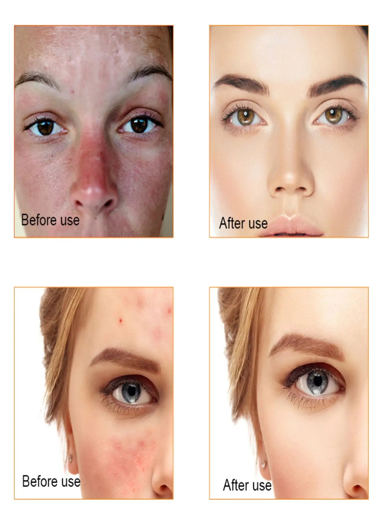TRSTAY Vitamin C Serum For Face Moisturizing Brightens Skin Repair Smooth Facial Essence Serum Facial Care Skincare Products Peaceful Pleasures Health and Wellness