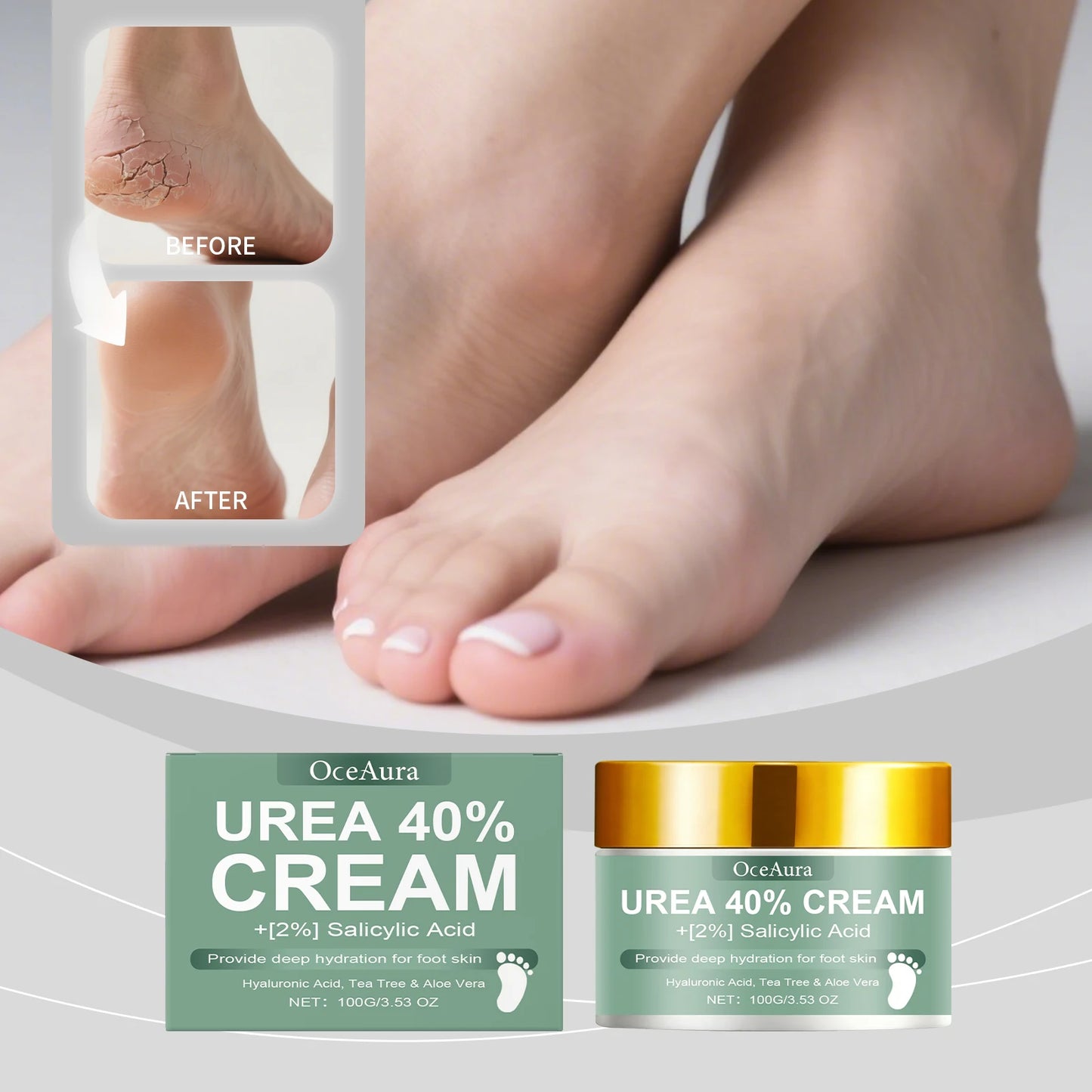 OceAura Urea 40% Foot Cream – Hydrating Heel & Skin Care
