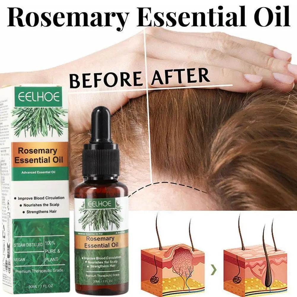 Rosemary Essential Oil for Hair Growth & Repair – 30ml