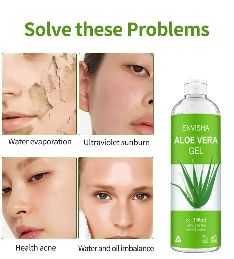 ENVISHA Aloe Vera Gel – Soothing, Hydrating & Sunburn Relief 300ml Aloe Vera Gel Peaceful Pleasures Health and Wellness