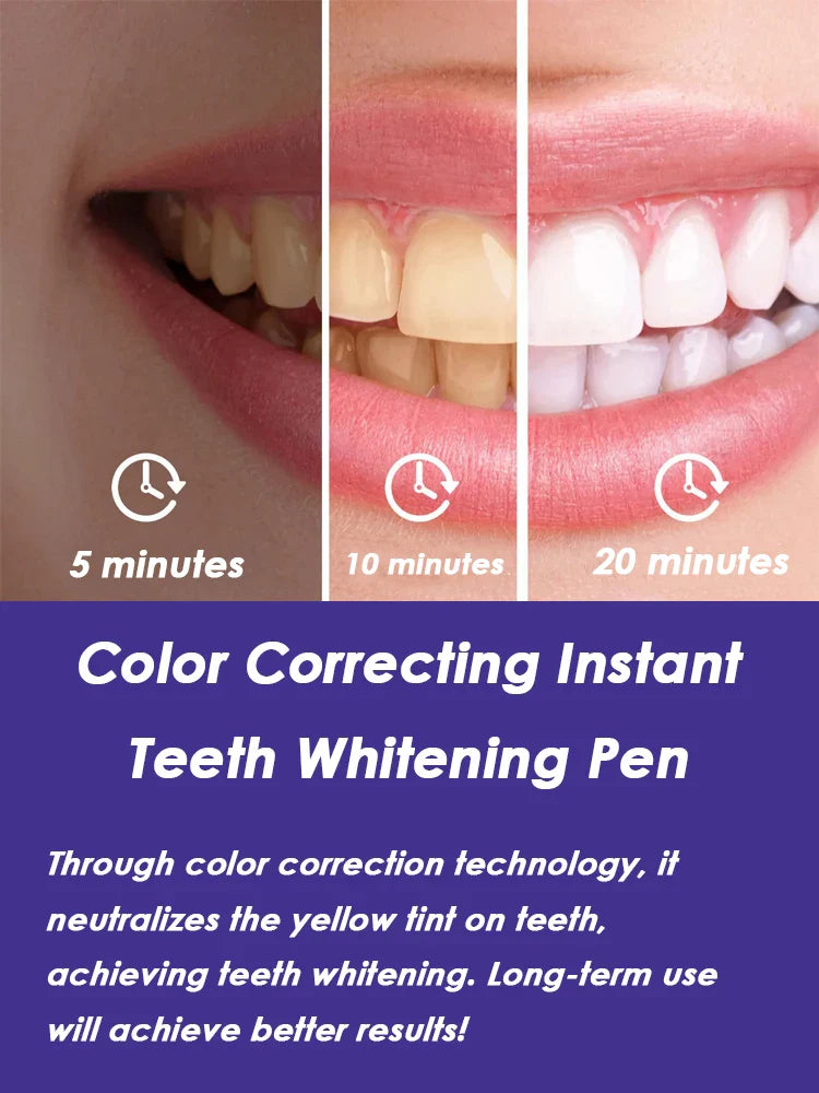 GlorySmile Purple Teeth Whitening Pen – No Sensitivity | 9ml