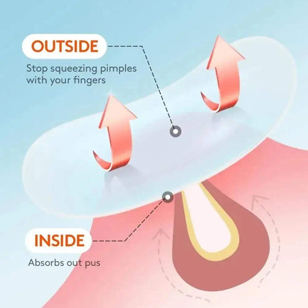 Hydrocolloid Star Acne Patches – Pimple Repair & Invisible Cover