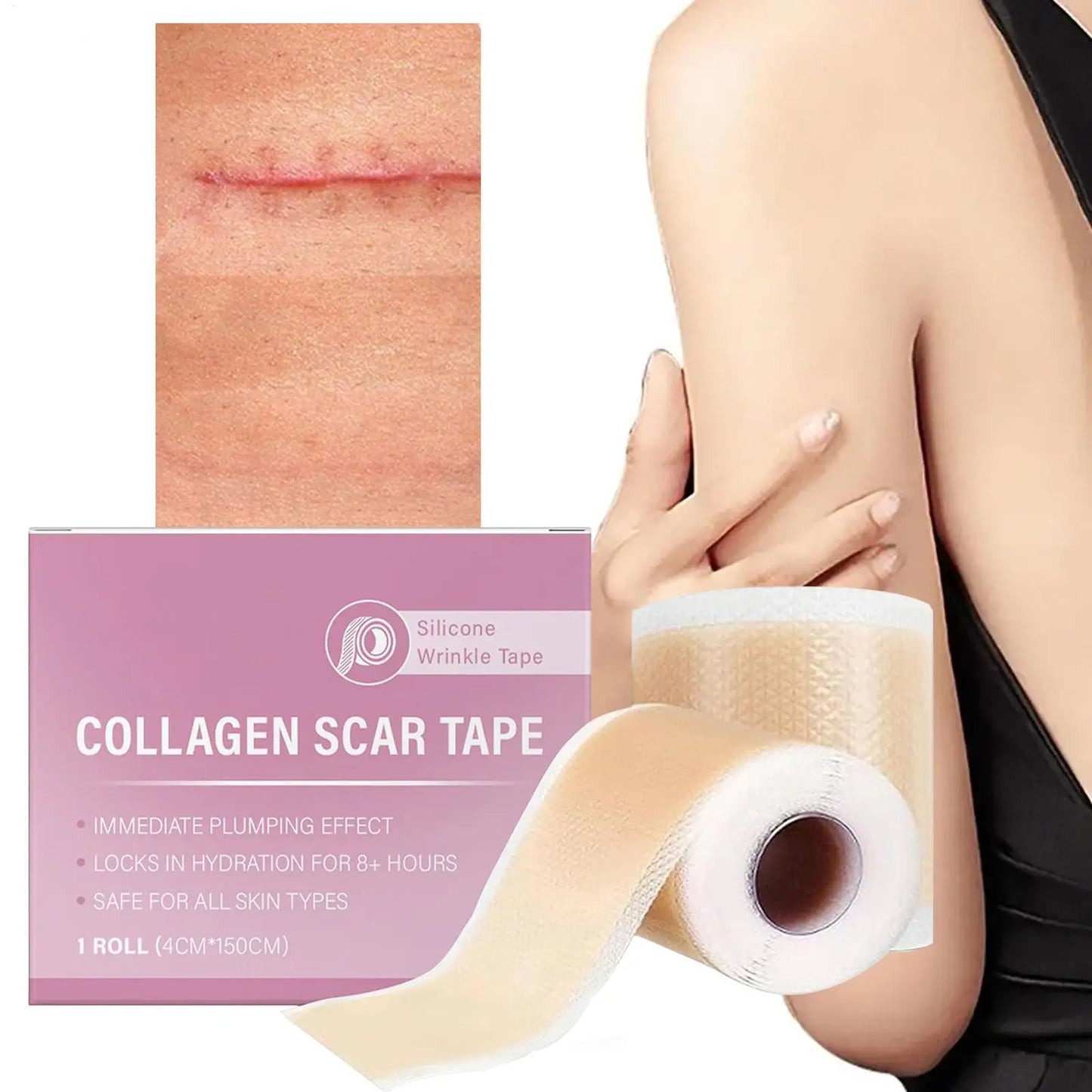 Scar Sheets 1 Roll Self-Adhesive Scar Cover Tape Skin Care Waterproof and Breathable Peaceful Pleasures Health and Wellness