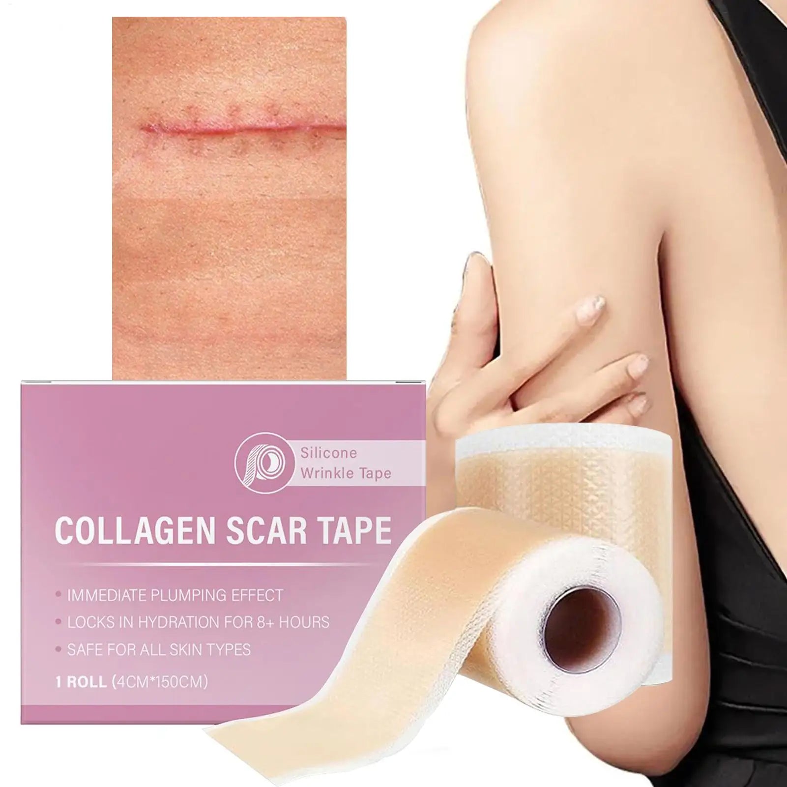 Scar Sheets 1 Roll Self-Adhesive Scar Cover Tape Skin Care Waterproof and Breathable Peaceful Pleasures Health and Wellness