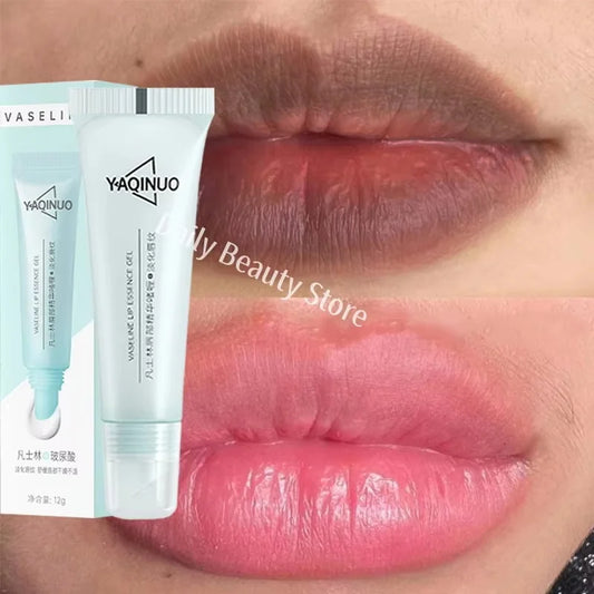 Eelhoe Lip Brightening Balm – Exfoliate, Hydrate & Restore Lip Brightening Balm Oasis Select