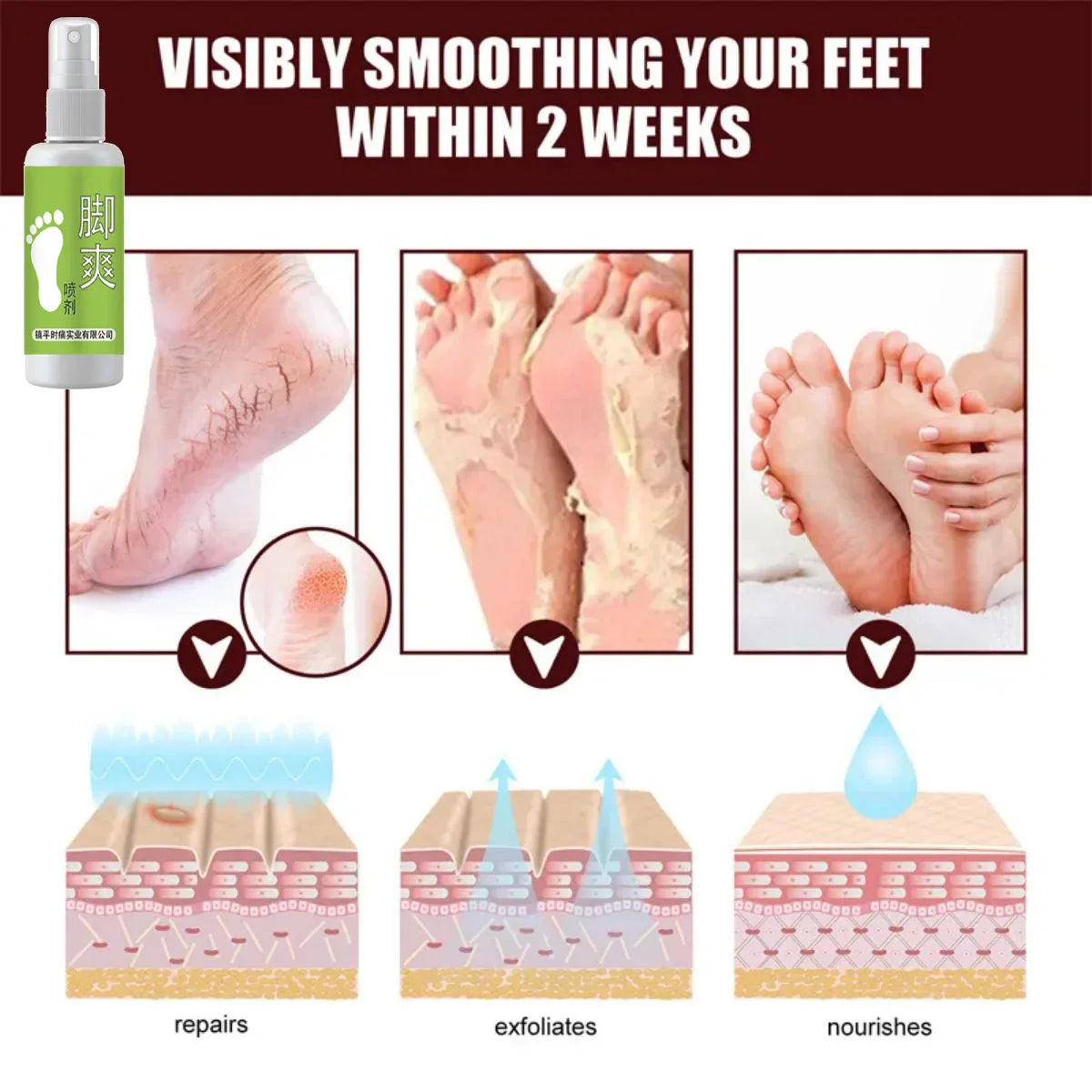 Essential Oil Foot Deodorant Spray – Odor Control & Freshness