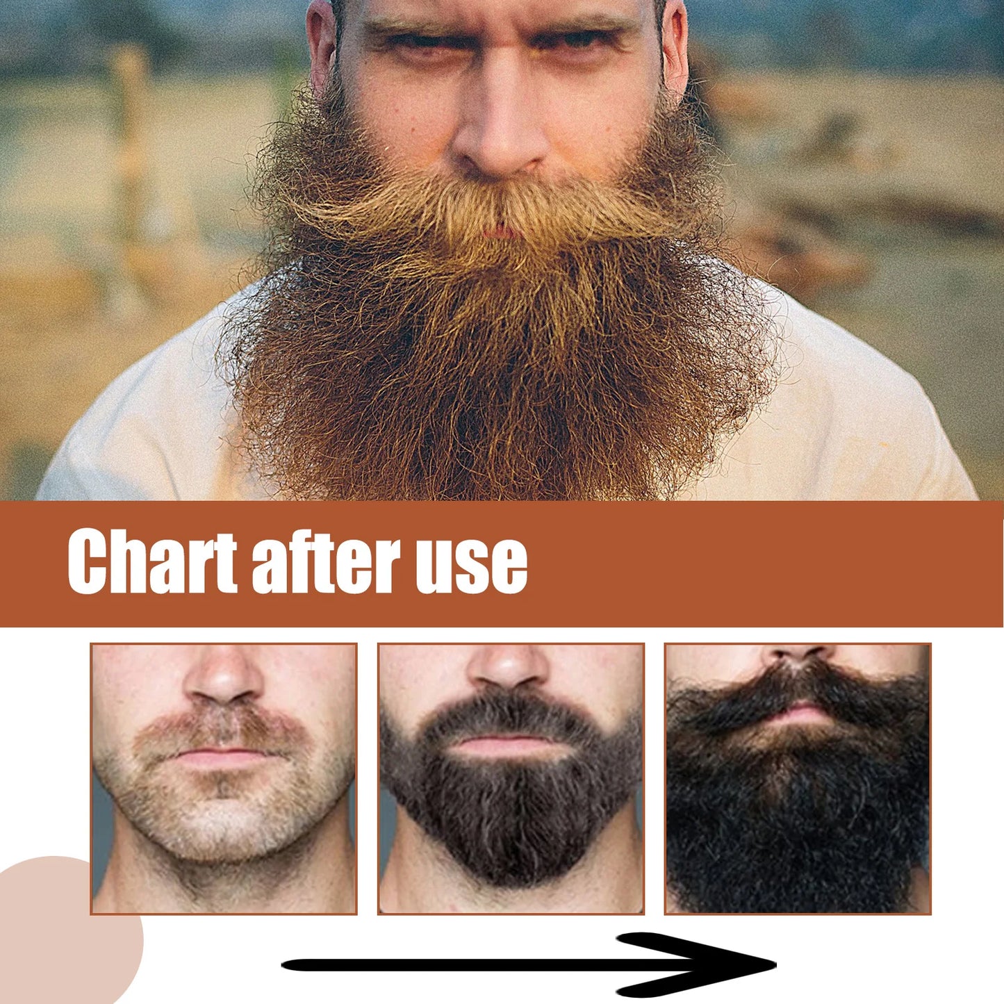 Organic Beard Growth Oil – Grapeseed & Ginger Root, 30ml