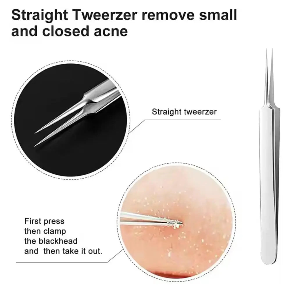 3-Piece Acne Needle Blackhead Extractor Kit | Stainless Steel