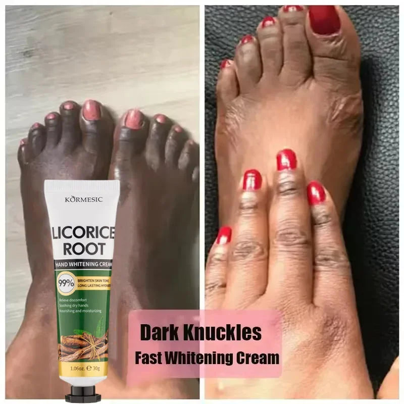 Dark Knuckle Brightening Hand Cream | Melanin Corrector 30g