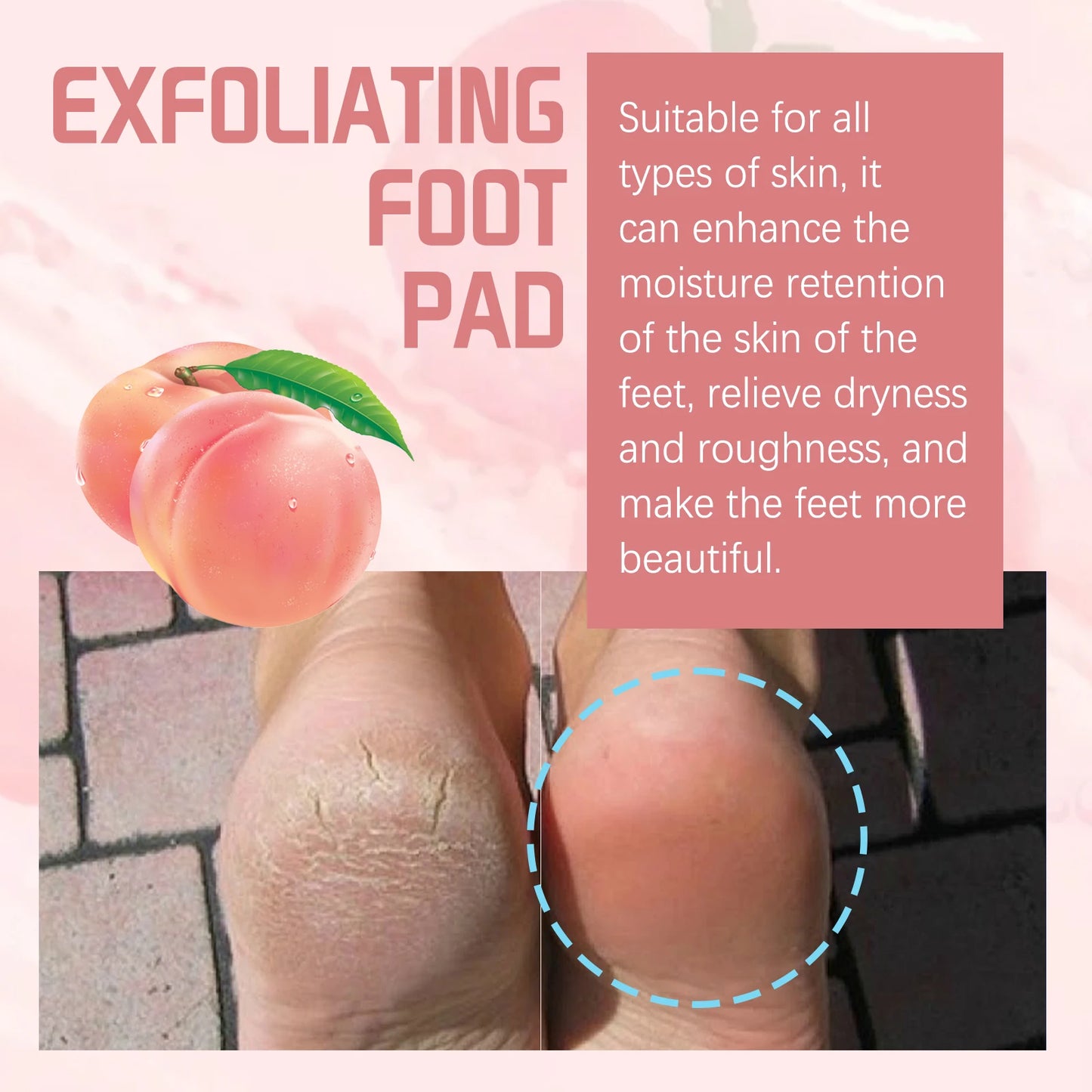 Peach Exfoliating Foot Mask Booties | Dead Skin Removal Socks